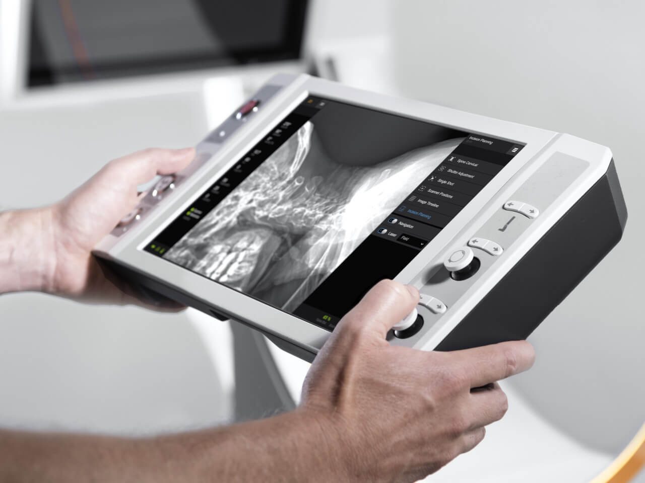 Descubra LoopX, robot móvil de adquisición de imágenes Brainlab